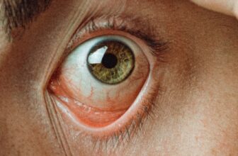 How Not To Attempt Contact Lenses